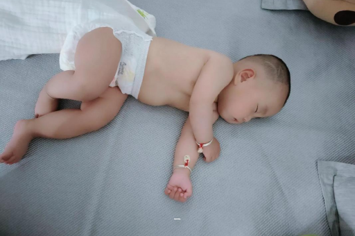 河池宝宝脸上有白色斑块